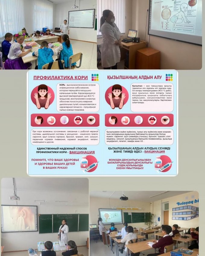 Қызылша (корь) ауруының алдын-алу.